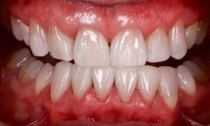 Cosmetic Dentistry