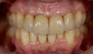 Cosmetic Dentistry