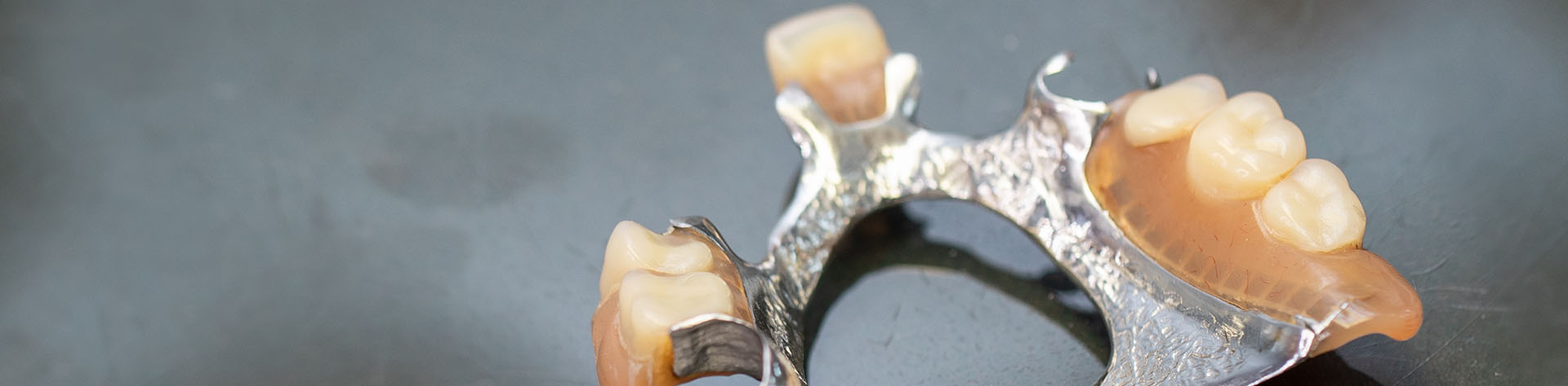 Dentures at Revitalise Dental Centre